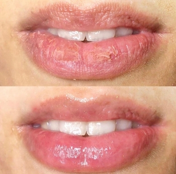 Hydra Gloss Lips Benefícios